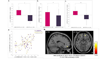 富山大学等研发出记忆干预程序：可缓解大脑反复回忆负面事件的倾向，有望用于压力相关精神障碍的预防与治疗