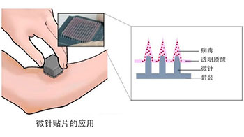 东京大学开发出新冠疫苗微针贴片，旨在实现自我接种和常温运输