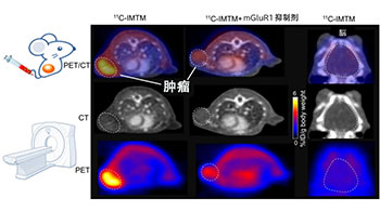 QST开发出兼具诊断与治疗的药剂，单次给药即可对原发灶和转移灶产生肿瘤抑制效果