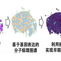 理研等预测肝癌发病风险，MYCN基因表达可作为指标