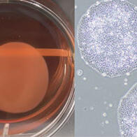 iPS细胞再生医疗产品在日本首次获批，心力衰竭等疾病的治疗选择将增加