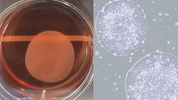 iPS细胞再生医疗产品在日本首次获批，心力衰竭等疾病的治疗选择将增加