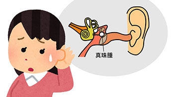 慈惠医科大学发现治疗急性白血病的药物对难治性慢性中耳炎有效