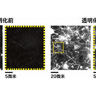 九州大学：实现活体哺乳动物生物组织的透明化及观察，通过调节细胞外液的折射率来推动神经科学发展