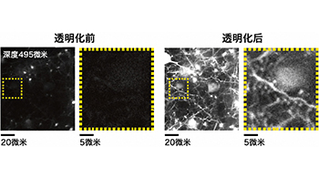 九州大学：实现活体哺乳动物生物组织的透明化及观察，通过调节细胞外液的折射率来推动神经科学发展