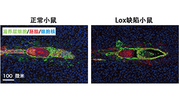 筑波大学学者发现促进胚胎着床后发育与胎盘形成的关键酶，为不孕症机制研究与治疗思路提供新线索