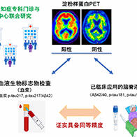 新潟大学等证实血液标志物“p-tau217”可高精度检测脑内β淀粉样蛋白蓄积，为低侵袭、高效率的阿尔茨海默病诊断开辟道路