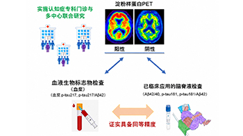 新潟大学等证实血液标志物“p-tau217”可高精度检测脑内β淀粉样蛋白蓄积，为低侵袭、高效率的阿尔茨海默病诊断开辟道路