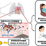 千叶大学鉴定出导致难治性疾病“肺高血压症”恶化的蛋白质“MYL9/12”，会引发血管结构恶化