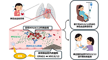 千叶大学鉴定出导致难治性疾病“肺高血压症”恶化的蛋白质“MYL9/12”，会引发血管结构恶化