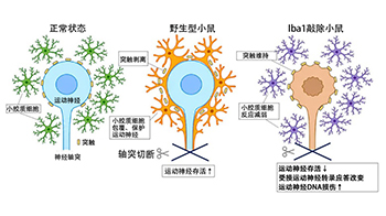 庆应义塾大学阐明脑内“游击手”小胶质细胞包裹保护受损神经细胞的机制，有望用于开发阿尔茨海默病等疾病疗法