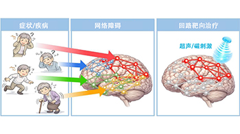 QST阐明tau蛋白病变通过脑回路引发认知症状，有望实现痴呆症预测与靶向回路治疗