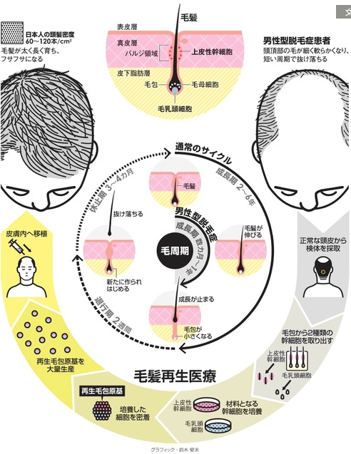 人体干细胞生发 秃顶男人的福音 客观日本
