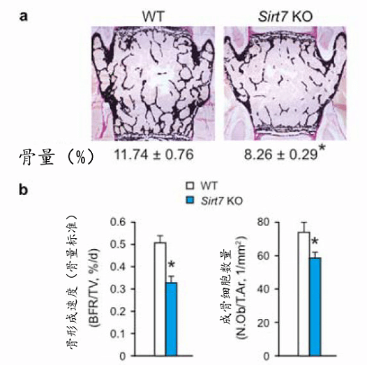 野生小鼠（WT）与缺少SIRT7基因（sirt7 KO）的小鼠的骨组织