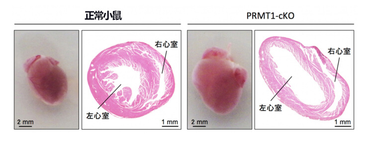 日本筑波大学查明幼龄患扩张型心肌病的原因