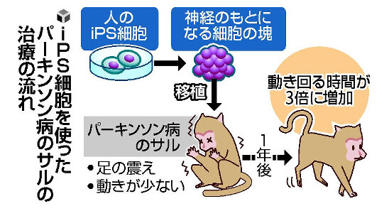 iPS细胞治疗帕金森氏症模式动物