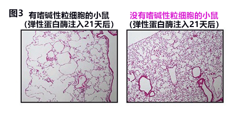 日本查明嗜碱性粒细胞与慢阻肺发病密切相关