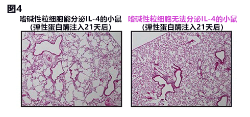 日本查明嗜碱性粒细胞与慢阻肺发病密切相关