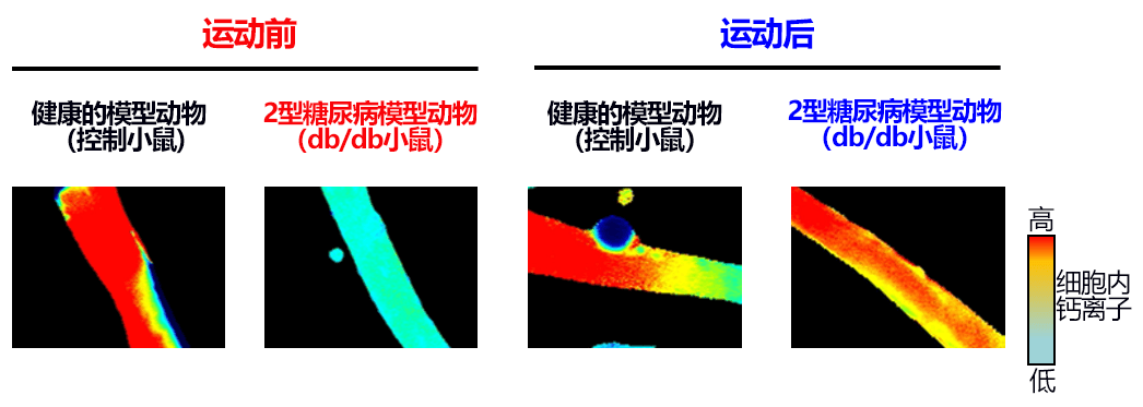 顺天堂大学查明2型糖尿病患者肌肉力量下降的原因