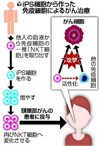 日本iPS细胞研究报告(廿一) 理研篇:癌症免疫细胞疗法临床试验