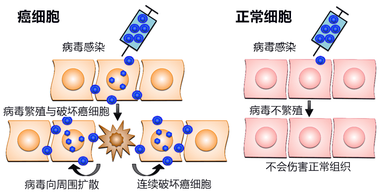 以毒攻毒，东京大学成功使用疱疹病毒治疗脑肿瘤，一年生存率达92.3%