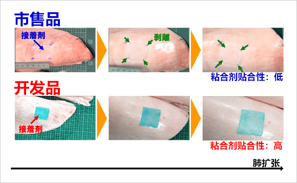 NIMS和筑波大学开发出呼吸也不会漏气的肺部手术粘合剂