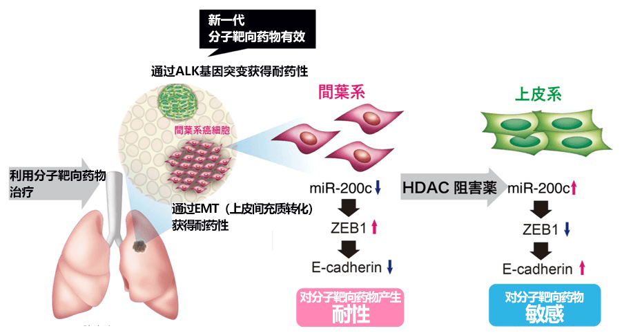 金泽大学查明肺癌细胞的分子靶向药物耐药性机理