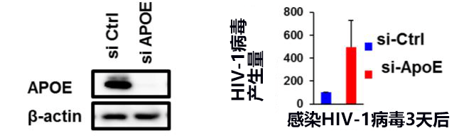 熊本大学发现能阻止艾滋病病毒感染繁殖的新体内物质