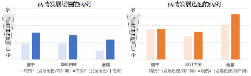 日本查明遗传性痴呆症发生的脑内异常