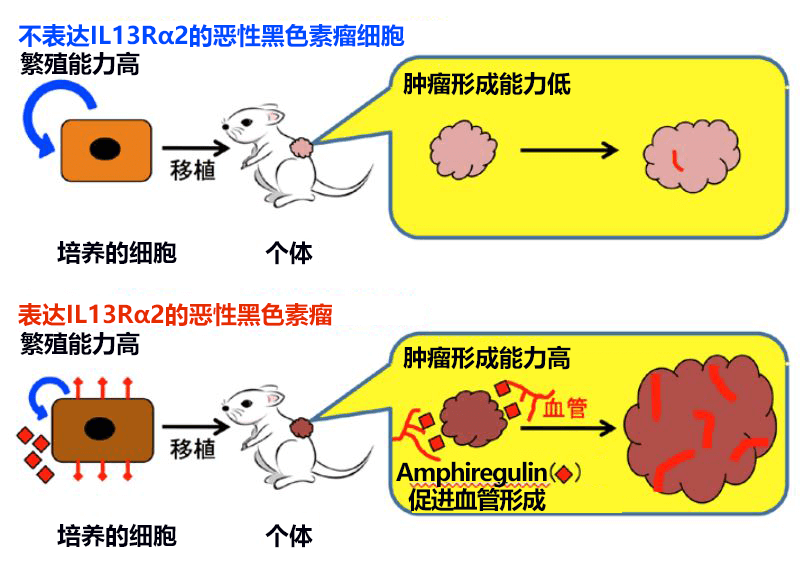 东京医科齿科大学与东京大学发现IL13Rα2导致恶性黑色素瘤恶化的机制