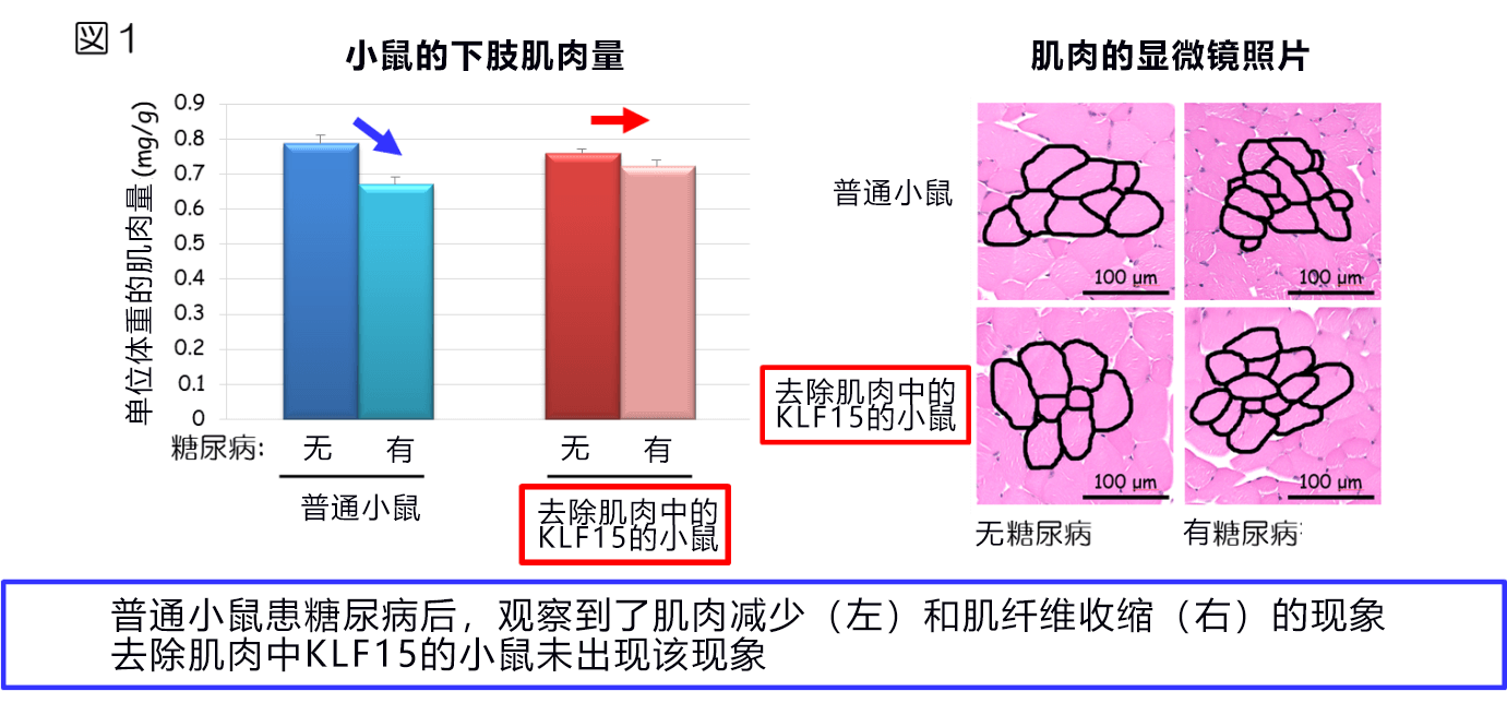 糖尿病患者为啥会瘦?神户大学查明糖尿病导致肌肉减少的机理