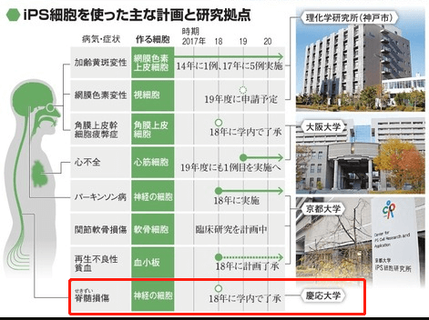 日本iPS细胞研究报告(廿四)庆应大学篇：脊髓损伤临床试验开始