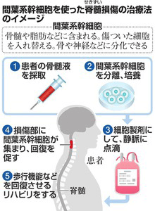 日本iPS细胞研究报告(廿四)庆应大学篇:脊髓损伤临床试验开始