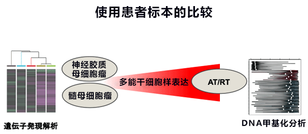 日本京都大学与东京大学利用人源iPS细胞制作脑肿瘤模型，查明儿童脑肿瘤病理