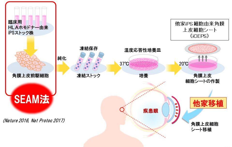 日本iPS细胞研究报告(廿七) 阪大篇:世界首例iPS角膜移植