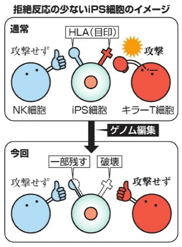 日本iPS细胞研究报告(廿八)京大篇：排斥反应规避技术