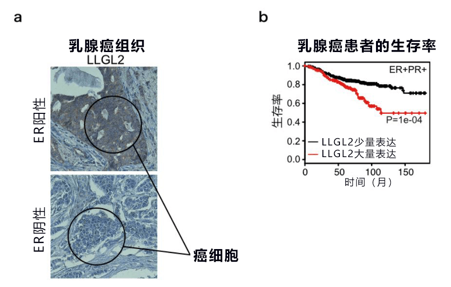 日美共同发现诱导乳腺癌细胞繁殖和导致药物失效的关键蛋白质