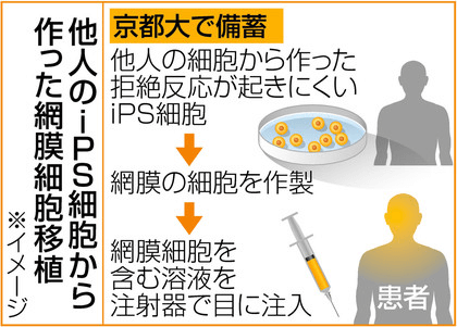 日本iPS细胞研究报告(廿九) 理研篇:确认视网膜移植试验安全性