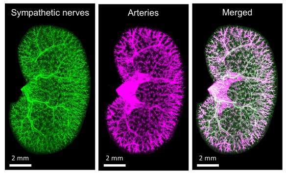 东大医学部实现肾脏透明化，在器官原始形态下实现荧光成像