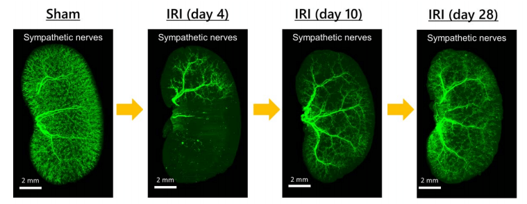 东大医学部实现肾脏透明化，在器官原始形态下实现荧光成像