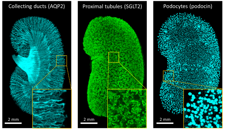东大医学部实现肾脏透明化，在器官原始形态下实现荧光成像