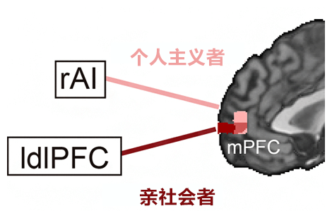 日本发现做决定时考虑他人利益的大脑回路