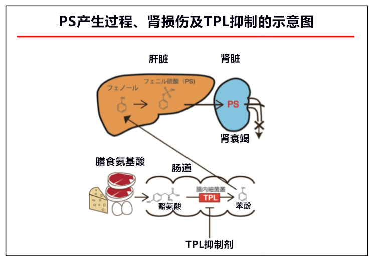 日本发现苯基硫酸盐是糖尿病肾病致病因子,有望开发新疗法
