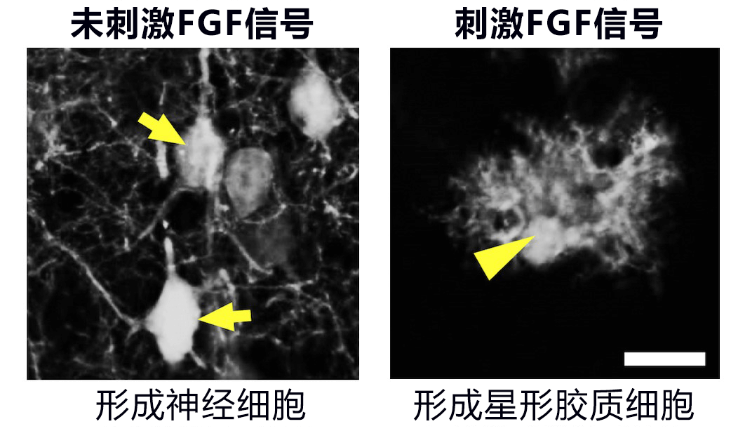 神经细胞还是星形胶质细胞？有个开关决定命运