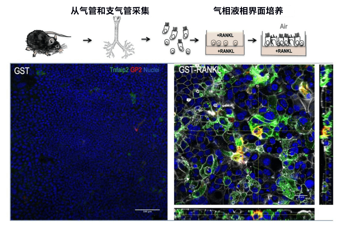 日本发现将空气中的异物吸收到体内的细胞，有望查明花粉症等过敏症机制