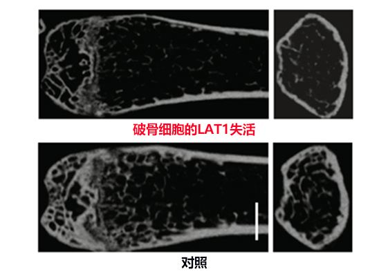 氨基酸对保持骨骼健康至关重要