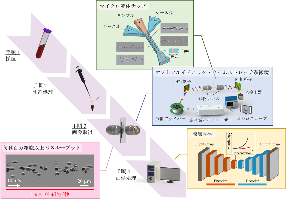 中日合力开发出白血病耐药性简易AI检测法