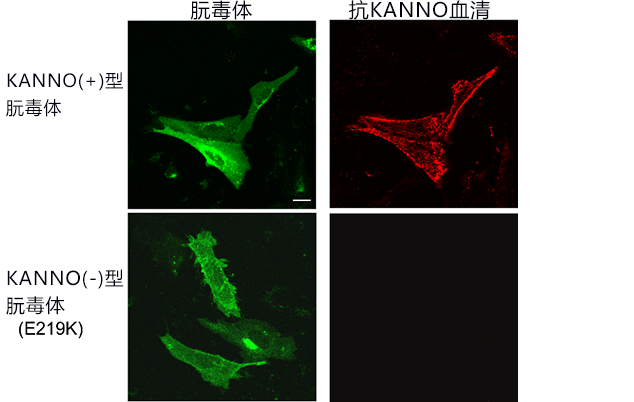 红色是与朊毒体表达细胞结合的KANNO型抗体