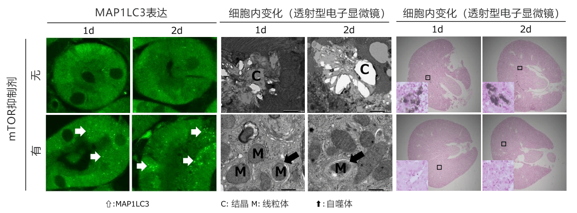 日本发现自噬功能降低会促进尿路结石形成