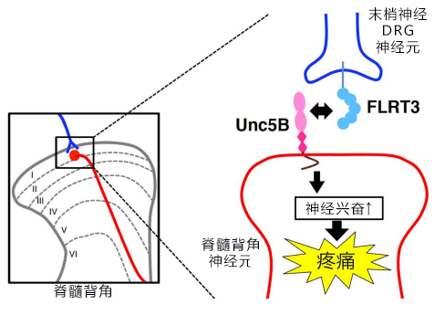 大阪大学确定FLRT3蛋白质会加剧神经性疼痛的疼痛感